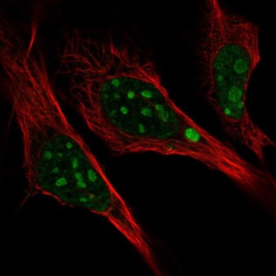 Immunocytochemistry/Immunofluorescence: L3MBTL3 Antibody [NBP2-14181] - Staining of human cell line U-2 OS shows localization to nucleoli.