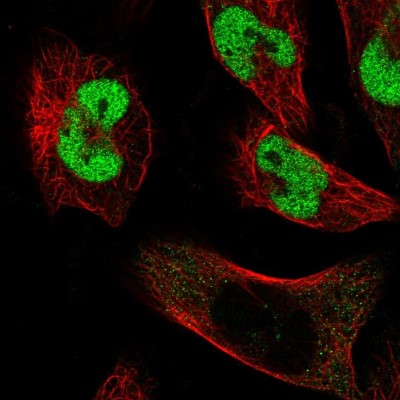 Immunocytochemistry/Immunofluorescence: CCDC85A Antibody [NBP1-93565] - Staining of human cell line U-251 MG shows positivity in nucleus but not nucleoli.