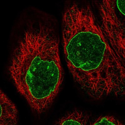 Immunocytochemistry/Immunofluorescence: TPR Antibody [NBP1-89451] - Immunofluorescent staining of human cell line A-431 shows localization to nuclear membrane.