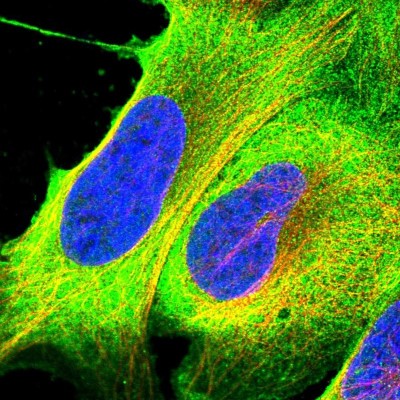 Immunocytochemistry/Immunofluorescence: RASAL1 Antibody [NBP2-13204] - Staining of human cell line U-2 OS shows positivity in plasma membrane and cytoplasm.