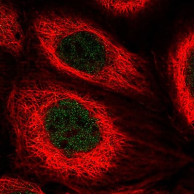 Immunocytochemistry/Immunofluorescence: TOX2 Antibody [NBP2-13464] - Immunofluorescent staining of human cell line A-431 shows localization to nucleoplasm.
