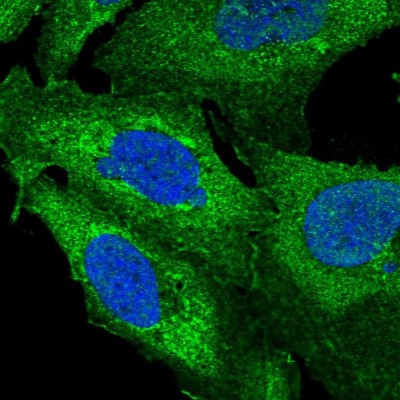 Immunocytochemistry/Immunofluorescence: ZNF2 Antibody [NBP1-89340] - Immunofluorescent staining of human cell line U-2 OS shows localization to plasma membrane & cytosol.
