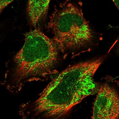 Immunocytochemistry/Immunofluorescence: EARS2 Antibody [NBP1-91857] - Immunofluorescent staining of human cell line U-251 MG shows localization to nucleoplasm & mitochondria.