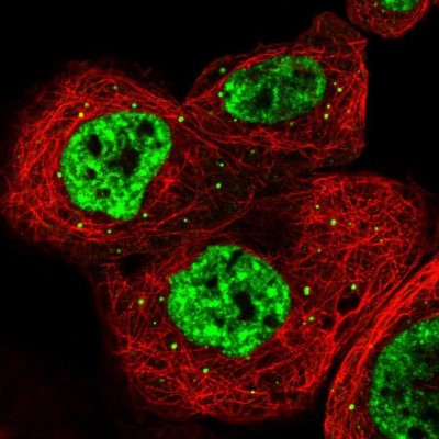 Immunocytochemistry/Immunofluorescence: RBM6 Antibody [NBP1-89377] - Staining of human cell line A-431 shows localization to nuclear speckles & cytoplasmic bodies.
