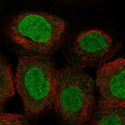Immunocytochemistry/Immunofluorescence: POMZP3 Antibody [NBP2-13788] - Staining of human cell line A-431 shows localization to nucleoplasm & nuclear membrane.