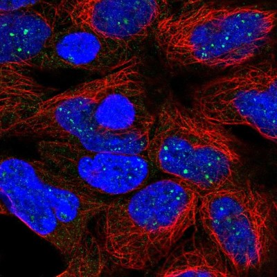 Immunocytochemistry/Immunofluorescence: DISP1 Antibody [NBP2-13925] - Immunofluorescent staining of human cell line HEK 293 shows localization to nuclear bodies.