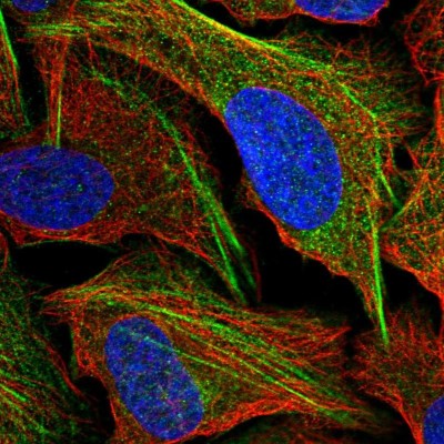 Immunocytochemistry/Immunofluorescence: DDX59 Antibody [NBP2-13909] - Staining of human cell line U-2 OS shows positivity in cytoskeleton (actin filaments).