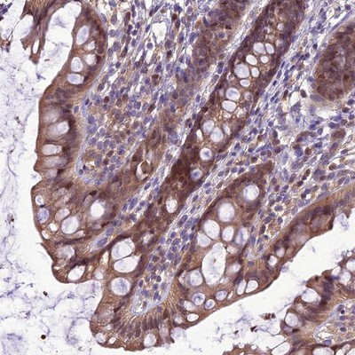 Immunohistochemistry-Paraffin: C17orf59 Antibody [NBP1-93992] - Staining of human rectum shows moderate cytoplasmic and nuclear positivity in glandular cells.