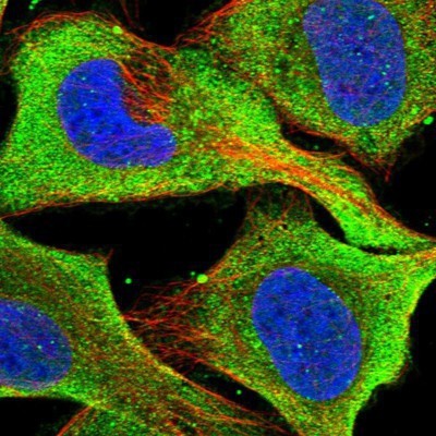 Immunocytochemistry/Immunofluorescence: Xrn1 Antibody [NBP1-89419] - Staining of human cell line U-2 OS shows positivity in plasma membrane and cytoplasm.