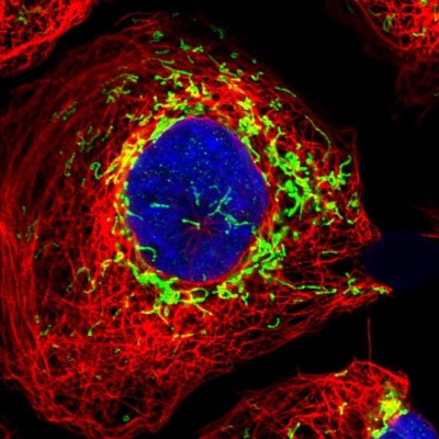 Immunocytochemistry/Immunofluorescence: C9orf9 Antibody [NBP1-90933] - Immunofluorescent staining of human cell line A-431 shows localization to mitochondria.
