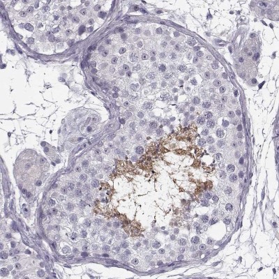 Immunohistochemistry-Paraffin: C9orf9 Antibody [NBP1-90933] - Staining of human testis shows strong positivity in flagella.