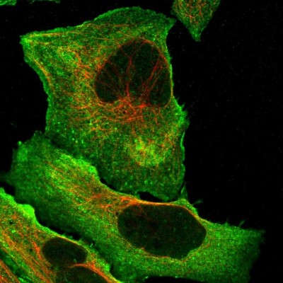 Immunocytochemistry/Immunofluorescence: DQX1 Antibody [NBP1-91849] - Immunofluorescent staining of human cell line U-2 OS shows localization to plasma membrane & cytosol.