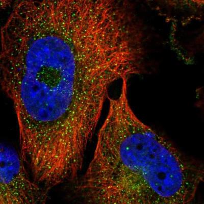 Immunocytochemistry/Immunofluorescence: USPL1 Antibody [NBP1-88973] - Staining of human cell line U-251 MG shows positivity in vesicles. Dilution 1-4 ug/ml