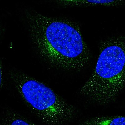 Immunocytochemistry/Immunofluorescence: DDA1 Antibody [NBP1-89891] - Staining of human cell line U-2 OS shows positivity in cytoskeleton (intermediate filaments).