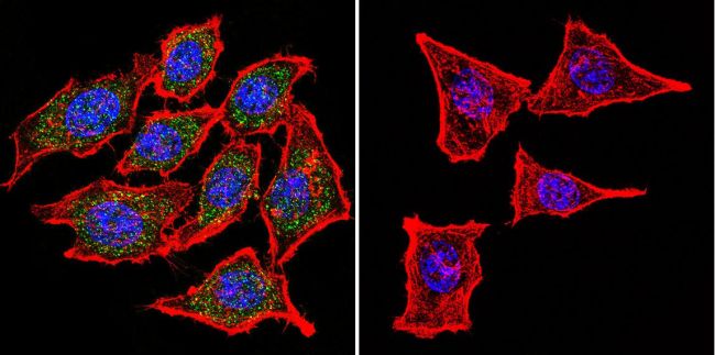 Immunofluorescent analysis of Nicotinic Acetylcholine Receptor using Anti-Nicotinic Acetylcholine Receptor Monoclonal Antibody (88B) (Product# MA3-043) shows staining in Hela Cells. Nicotinic Acetylcholine Receptor staining (green), F-Actin staining with Phalloidin (red) and nuclei with DAPI (blue) is shown. Cells were grown on chamber slides and fixed with formaldehyde prior to staining. Cells were probed without (control) or with or an antibody recognizing Nicotinic Acetylcholine Receptor (Product# MA3-043) at a dilution of 1:100 over night at 4 ◦C, washed with PBS and incubated with a DyLight-488 conjugated secondary antibody (Product# 35503, Goat Anti-Mouse). Images were taken at 60X magnification.