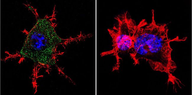 Immunofluorescent analysis of Nicotinic Acetylcholine Receptor using Anti-Nicotinic Acetylcholine Receptor Monoclonal Antibody (88B) (Product# MA3-043) shows staining in Neuro-2a Cells. Nicotinic Acetylcholine Receptor staining (green), F-Actin staining with Phalloidin (red) and nuclei with DAPI (blue) is shown. Cells were grown on chamber slides and fixed with formaldehyde prior to staining. Cells were probed without (control) or with or an antibody recognizing Nicotinic Acetylcholine Receptor (Product# MA3-043) at a dilution of 1:100 over night at 4 ◦C, washed with PBS and incubated with a DyLight-488 conjugated secondary antibody (Product# 35503, Goat Anti-Mouse). Images were taken at 60X magnification.