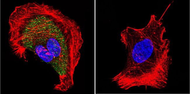 Immunofluorescent analysis of Nicotinic Acetylcholine Receptor using Anti-Nicotinic Acetylcholine Receptor Monoclonal Antibody (88B) (Product# MA3-043) shows staining in U251 Cells. Nicotinic Acetylcholine Receptor staining (green), F-Actin staining with Phalloidin (red) and nuclei with DAPI (blue) is shown. Cells were grown on chamber slides and fixed with formaldehyde prior to staining. Cells were probed without (control) or with or an antibody recognizing Nicotinic Acetylcholine Receptor (Product# MA3-043) at a dilution of 1:20 over night at 4 ◦C, washed with PBS and incubated with a DyLight-488 conjugated secondary antibody (Product# 35503, Goat Anti-Mouse). Images were taken at 60X magnification.
