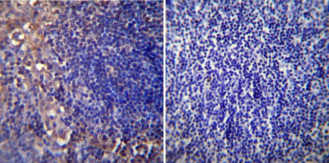 Immunohistochemistry was performed on normal biopsies of deparaffinized Mouse lymph node tissue. To expose target proteins, heat induced antigen retrieval was performed using 10mM sodium citrate (pH6.0) buffer, microwaved for 8-15 minutes. Following antigen retrieval tissues were blocked in 3% BSA-PBS for 30 minutes at room temperature. Tissues were then probed at a dilution of 1:20 with a mouse monoclonal antibody recognizing Nicotinic Acetylcholine Receptor (MA3-043) or without primary antibody (negative control) overnight at 4°C in a humidified chamber. Tissues were washed extensively with PBST and endogenous peroxidase activity was quenched with a peroxidase suppressor. Detection was performed using a biotin-conjugated secondary antibody and SA-HRP, followed by colorimetric detection using DAB. Tissues were counterstained with hematoxylin and prepped for mounting.