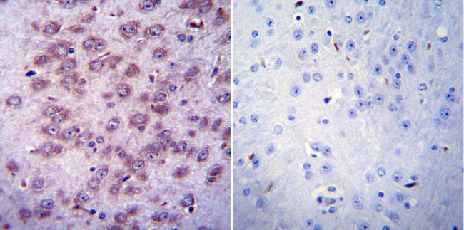 Immunohistochemistry was performed on normal biopsies of deparaffinized Mouse brain tissue. To expose target proteins, heat induced antigen retrieval was performed using 10mM sodium citrate (pH6.0) buffer, microwaved for 8-15 minutes. Following antigen retrieval tissues were blocked in 3% BSA-PBS for 30 minutes at room temperature. Tissues were then probed at a dilution of 1:20 with a mouse monoclonal antibody recognizing Nicotinic Acetylcholine Receptor (MA3-043) or without primary antibody (negative control) overnight at 4°C in a humidified chamber. Tissues were washed extensively with PBST and endogenous peroxidase activity was quenched with a peroxidase suppressor. Detection was performed using a biotin-conjugated secondary antibody and SA-HRP, followed by colorimetric detection using DAB. Tissues were counterstained with hematoxylin and prepped for mounting.