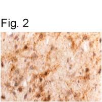 Immunohistochemical staining of Leptin in sheep brain using PA1-051.