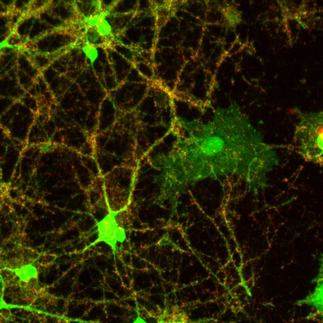 Synaptophysin Antibody (PA1-1043) in IF