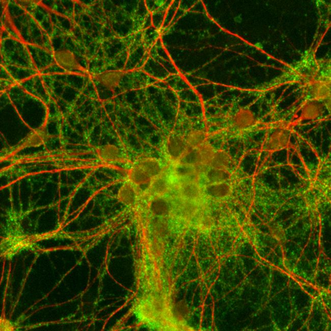 Synaptophysin Antibody (PA1-1043) in IF
