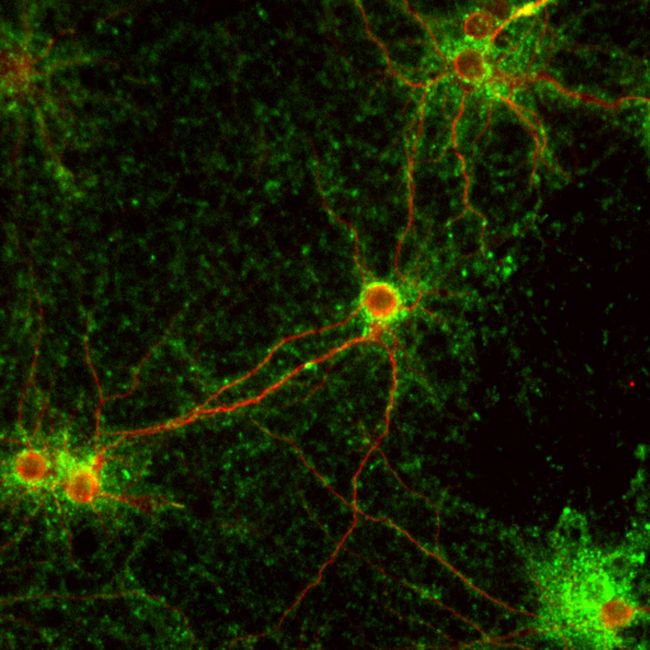 Synaptophysin Antibody (PA1-1043) in IF