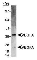 Detection of VEGFA doublet in CSF-IR/VEGFA chimera transfected lysate using PA1-16948. ECL 10 second exposure.