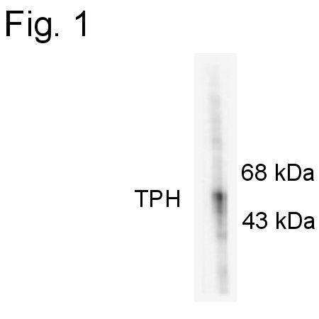 Western blot of recombinant rabbit tryptophan hydroxylase in a crude bacterial lysate incubated in the absence (Control) and presence of cAMP-dependent protein kinase (PKA).