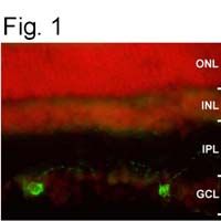 Immunofluorescence staining of melanopsin in rat retinal ganglion cells using PA1-781.