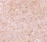 Immunohistochemical staining of mouse brain using a Caspase 13 polyclonal antibody (Product # PA1-84169)