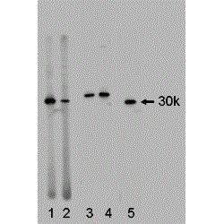 Western blot analysis of 14-3-3 isoforms in HEK293 cell extracts using a 14-3-3 gamma polyclonal antibody (Product # PA1-86556) (lane 1), a zeta 14-3-3 (lane 2), a C-epsilon-14-3-3 (lane 3), a N-epsilon-14-3-3 (Lane 4), a eta 14-3-3 (Lane 5). The 14-3-3 isoforms run at 30kDa except epsilon 14-3-3.