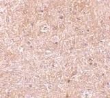 Immunohistochemical analysis of Caspase 13 in mouse brain tissue using a Caspase 13 polyclonal antibody (Product # PA1-30684).