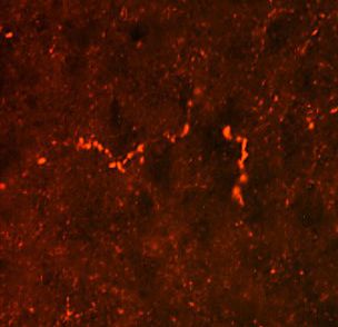Immunofluorescent analysis of Prodynorphin in rat hypothalamus using a Prodynorphin polyclonal antibody (Product # PA1-30935) (red).