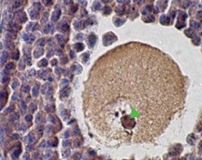 Immunohistochemical analysis of SCP1 in paraffin-embedded mouse ovary tissue using a SCP1 polyclonal antibody (Product # PA1-31223).