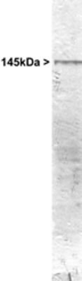 Western blot analysis of NEFM in rat cerebellum whole cell homogenate using a NEFM polyclonal antibody (Product # PA1-32348).