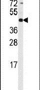 Western blot analysis using a RMND5B polyclonal antibody (Product # PA5-12399) in NCI-H460 cell lysates (35ug per lane).