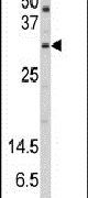 Western blot analysis using a SNURF polyclonal antibody (Product # PA5-12422) in HeLa cell lysates (35ug per lane).
