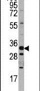 Western blot analysis using a Hmx3 polyclonal antibody (Product # PA5-14323) in mouse stomach tissue lysates (35ug per lane).