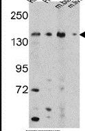 Western blot analysis using an OPLAH polyclonal antibody (Product # PA5-14384) in K562, HepG2, mouse bladder and mouse liver tissue lysates (35ug per lane).