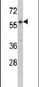 Western blot analysis using a CARS2 polyclonal antibody (Product # PA5-14999) in NCI-H460 cell lysates (35ug per lane).