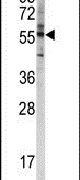 Western blot analysis using a CYP4F8 polyclonal antibody (Product # PA5-15057) in K562 cell lysates (35ug per lane).