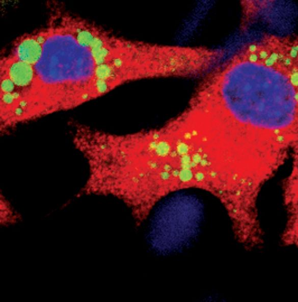 Immunofluorescent analysis of SCD1 in NIH/3T3-L1 cells, using a SCD1 monoclonal antibody (Product # MA5-14885) (red) showing cytoplasmic localization in differentiated cells. Lipid droplets have been labeled with a BODIPY fluorescent dye (green). DNA is labeled using a fluorescent blue dye.