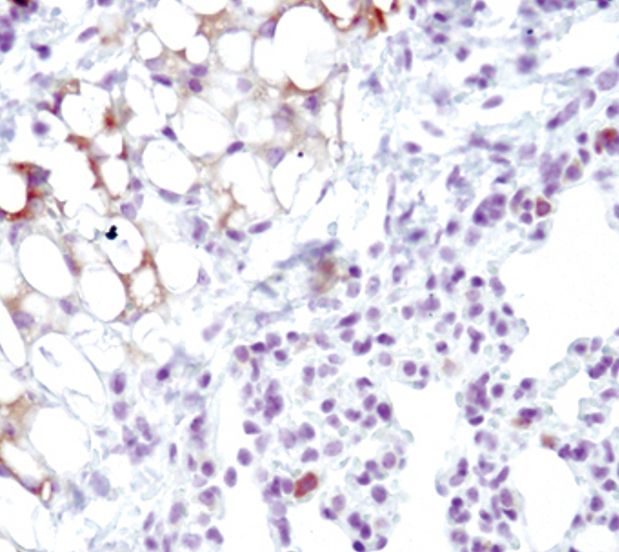 Immunohistochemical analysis of SCD1 in paraffin-embedded mouse lung using a SCD1 monoclonal antibody (Product # MA5-14885) (left) or without primary antibody (right).
