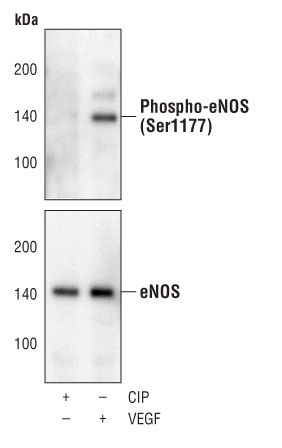Western blot analysis of Phospho-eNOS pSer1177 in extracts from BAEC cells, phosphatase or VEGF-treated using Phospho-eNOS pSer1177 monoclonal antibody (Product # MA5-14957) (upper) or an ENOS polyclonal antibody (lower).
