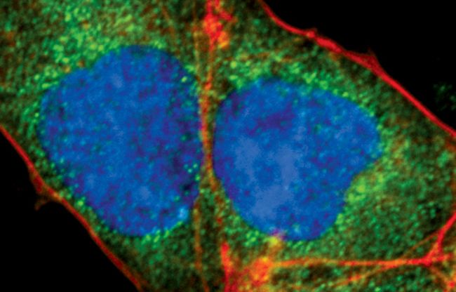 Immunofluorescent analysis of Cripto in P19 cells using a Cripto polyclonal antibody (Product # PA5-17191) (green). Actin filaments are labeled with a fluorescent red phalloidin. DNA is labeled using a fluorescent blue dye.