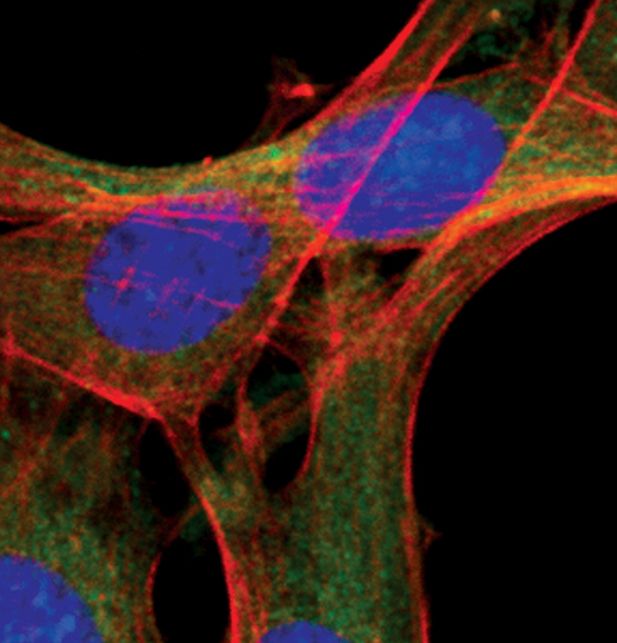 Immunofluorescent analysis of Atg12 in NIH/3T3 cells, chloroquine-treated, using an Atg12 polyclonal antibody (Product # PA5-17218) (green). Actin filaments are labeled with a fluorescent red phalloidin. DNA is labeled using a fluorescent blue dye.