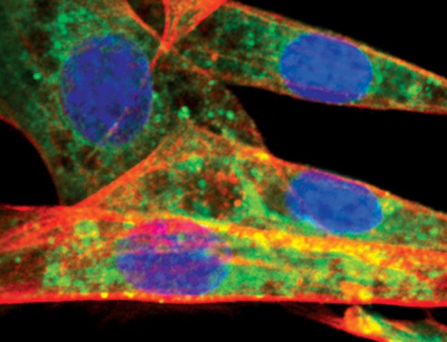 Immunofluorescent analysis of Atg12 in NIH/3T3 cells using an Atg12 polyclonal antibody (Product # PA5-17218) (green). Actin filaments are labeled with a fluorescent red phalloidin. DNA is labeled using a fluorescent blue dye.