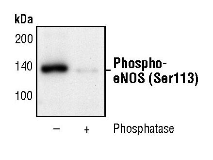 Western blot analysis of Phospho-eNOS pSer113 in extracts from bovine aortic endothelial cells (BAEC), untreated or treated with lambda phosphatase, using Phospho-eNOS pSer113 polyclonal antibody (Product # PA5-17548) (upper) or eNOS antibody (lower).