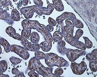 HIF-1 alpha Antibody (MA5-16016) in IHC